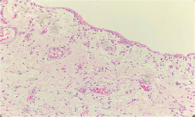 Key image 3