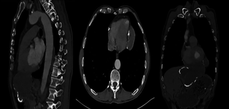 Key image 1