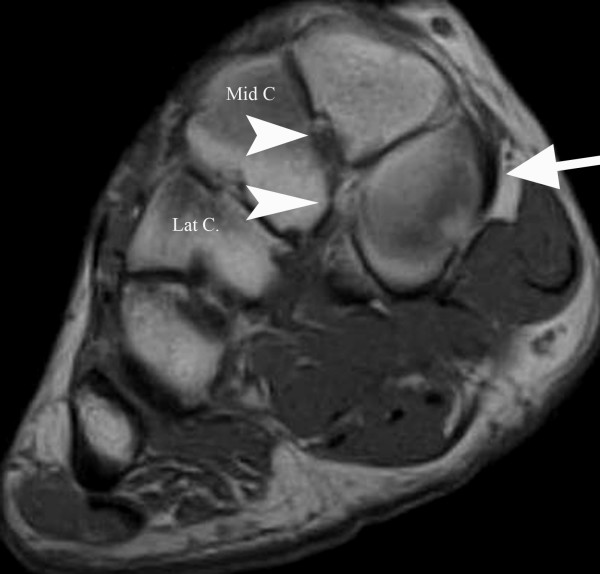 Key image 3