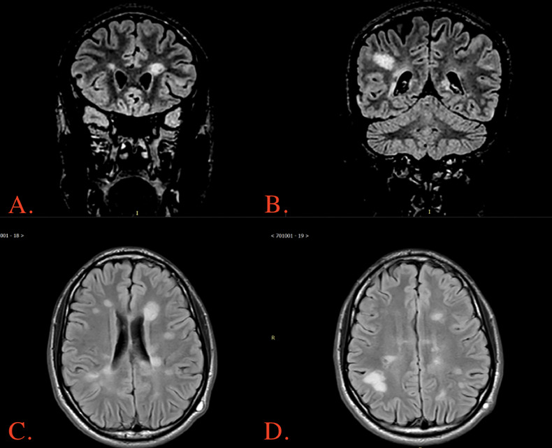 Key image 1