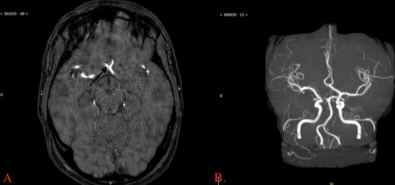 Key image 2