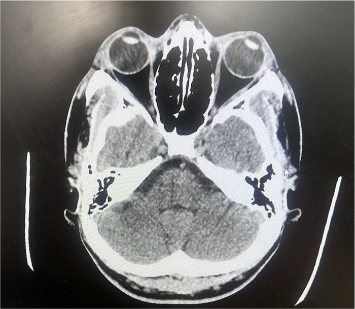 Key image 3