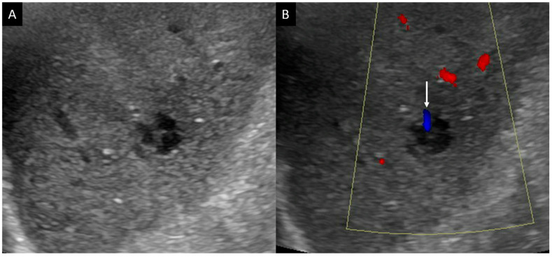 Key image 1