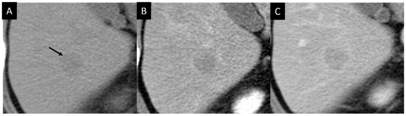 Key image 3