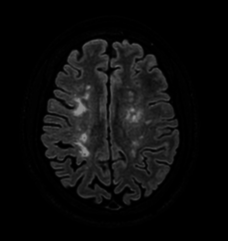 Key image 1