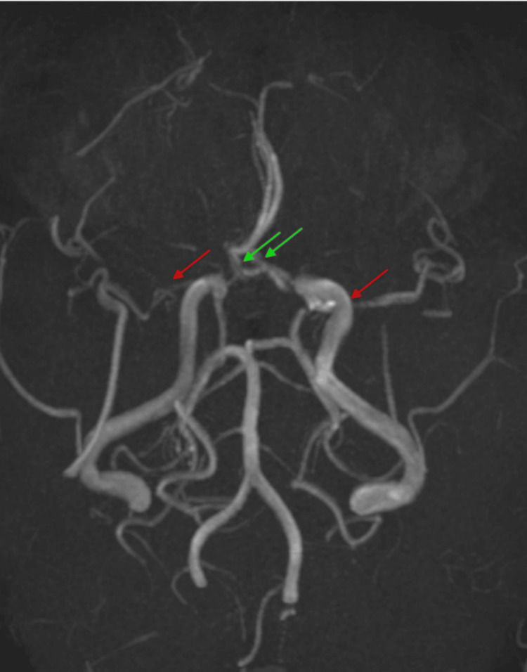 Key image 3