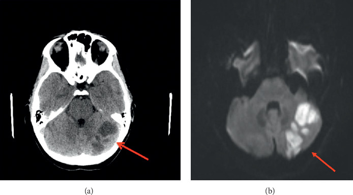 Key image 1
