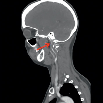 Key image 2