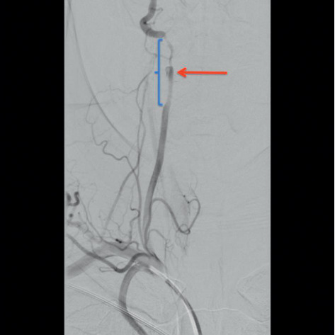 Key image 3