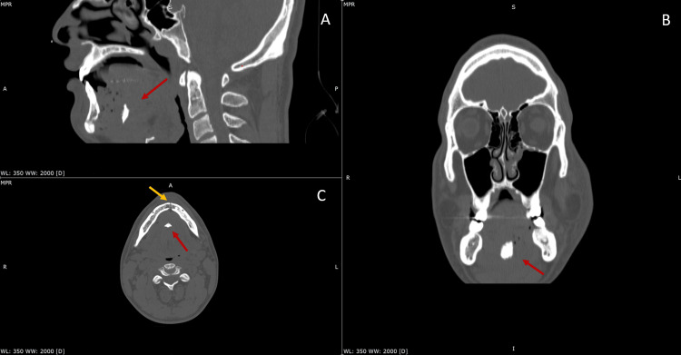 Key image 1