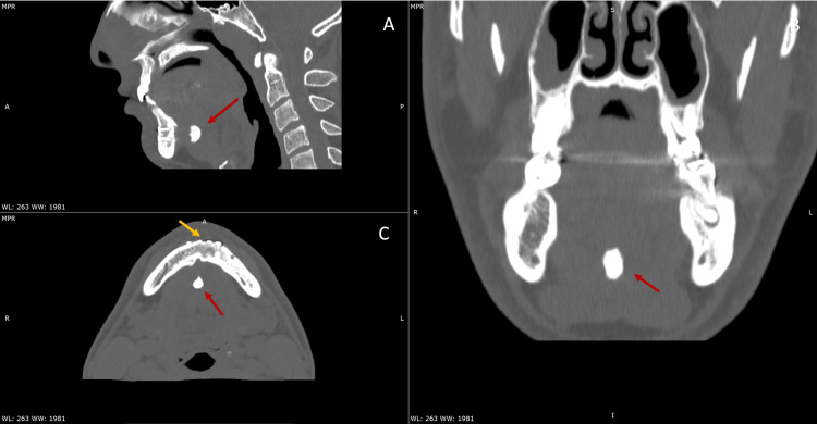 Key image 2