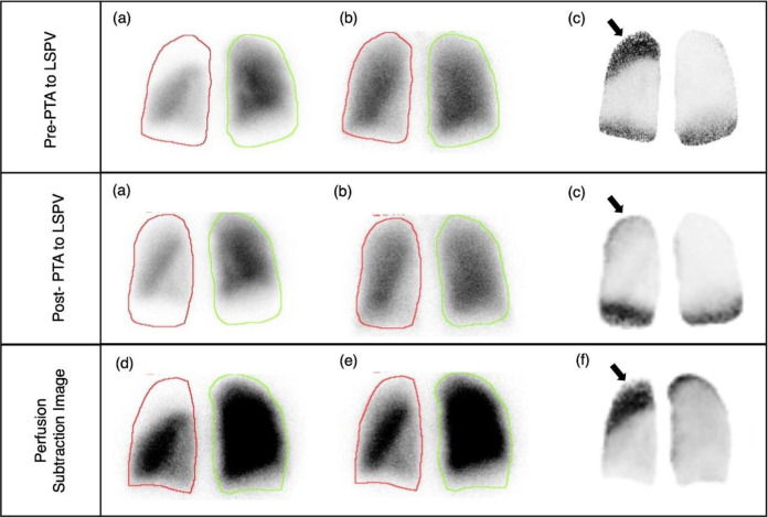 Key image 3