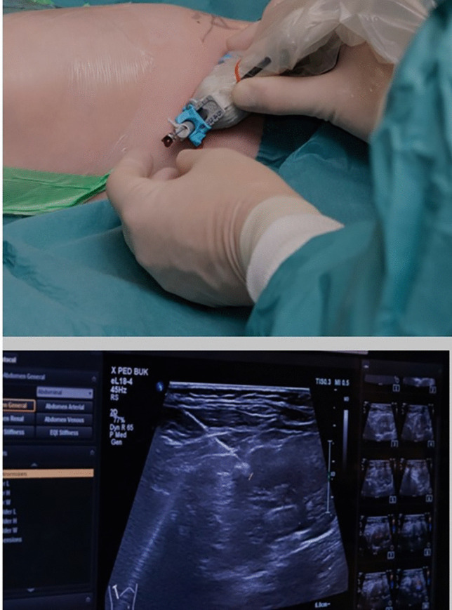 Key image 1