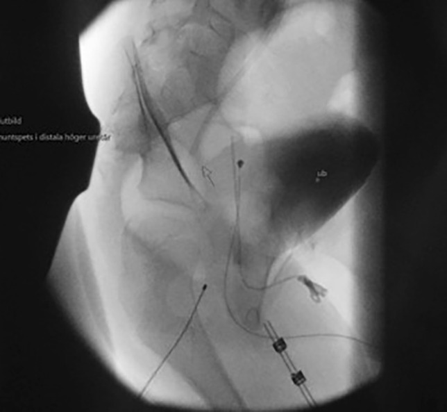 Key image 2