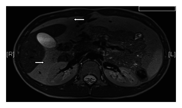 Key image 1