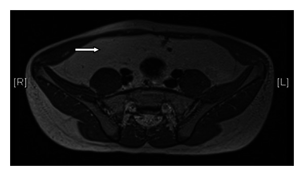 Key image 2