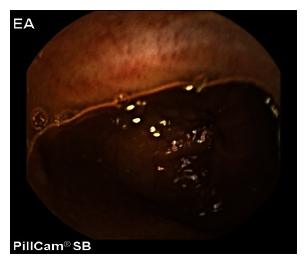 Key image 3