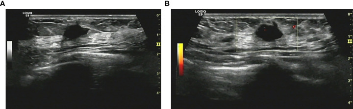 Key image 1