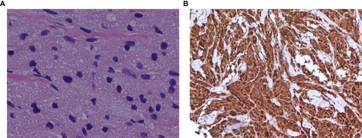 Key image 3