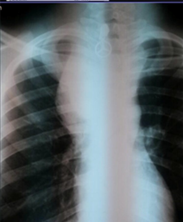 Key image 1