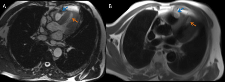 Key image 3