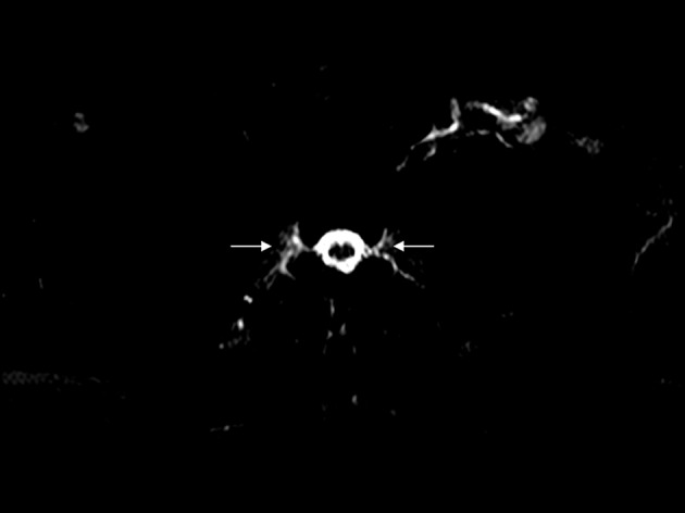 Key image 1