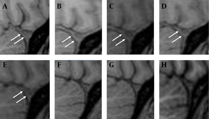 Key image 2