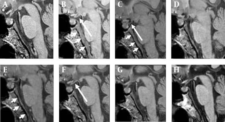 Key image 3