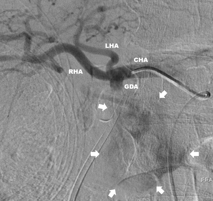 Key image 1