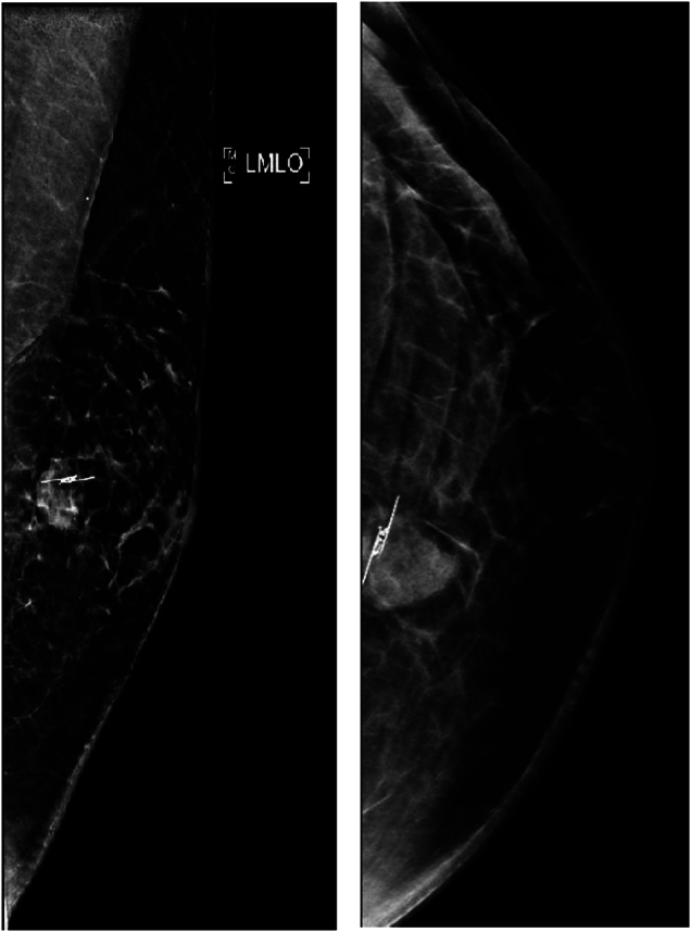 Key image 3