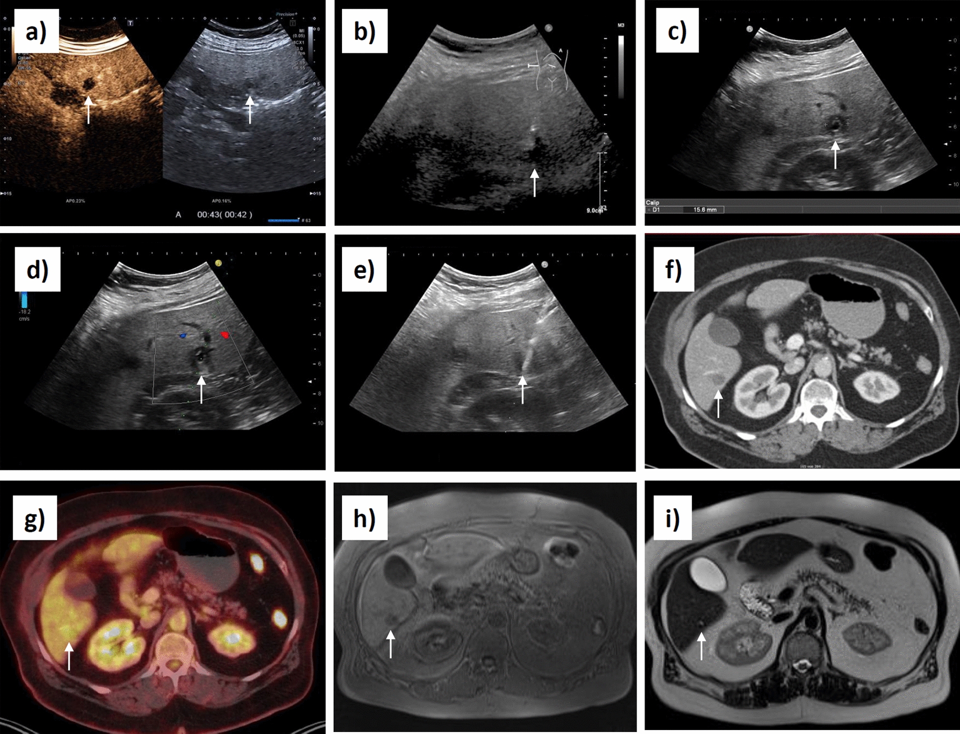 Key image 3