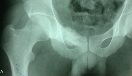 Key image 1