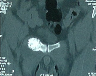 Key image 2