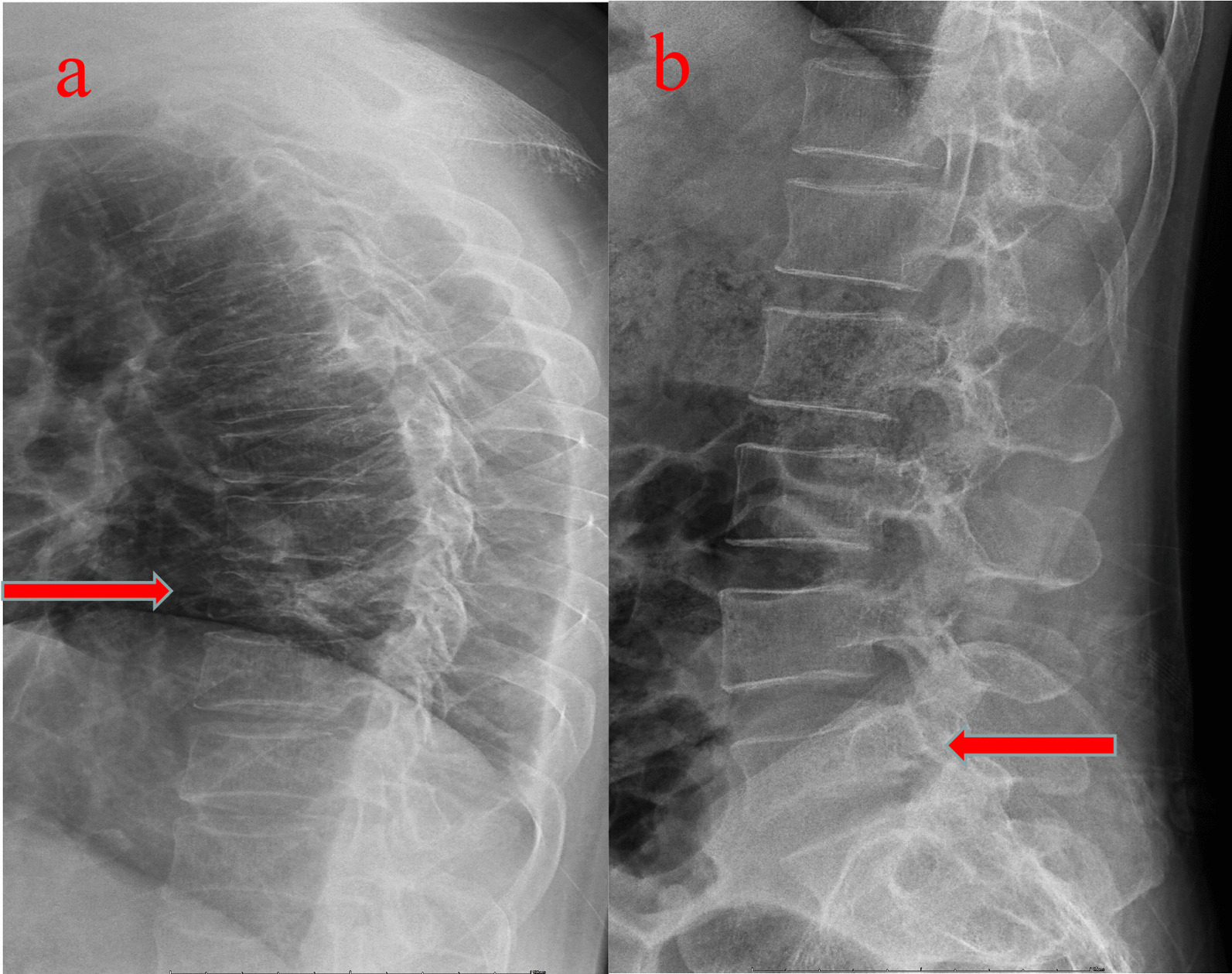 Key image 1