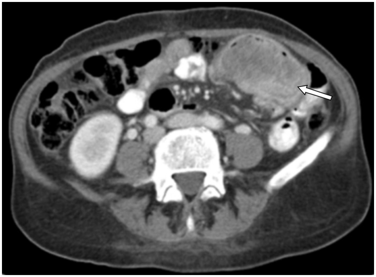 Key image 1