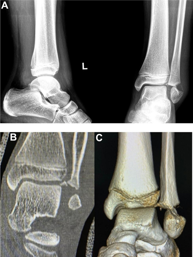 Key image 1