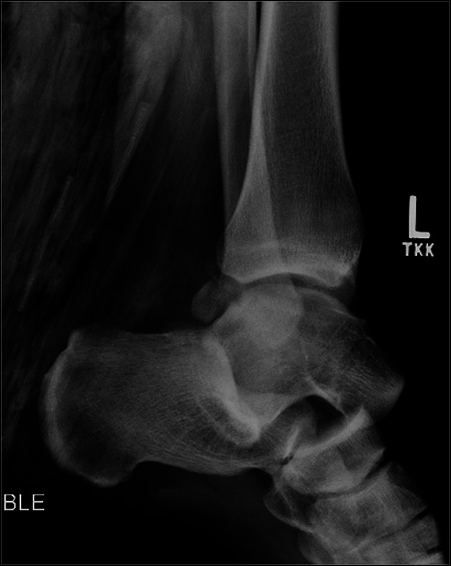 Key image 2