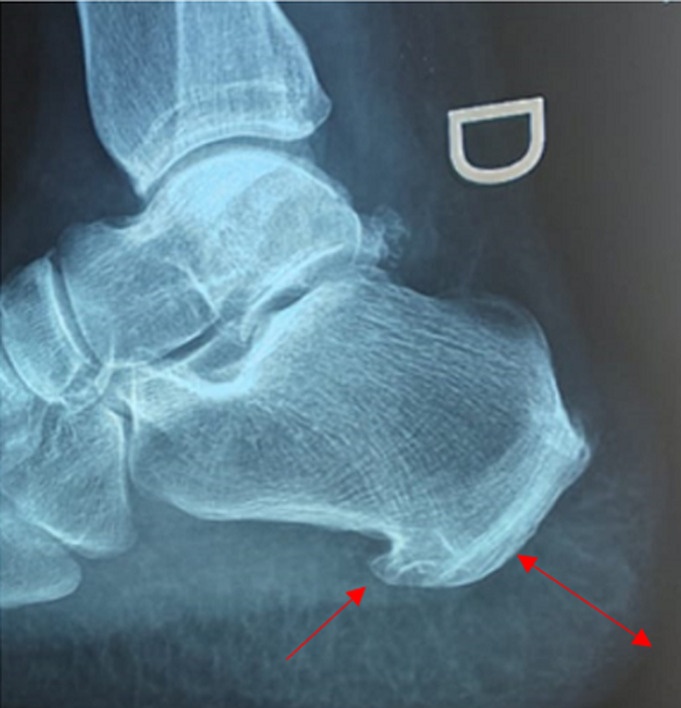 Key image 1
