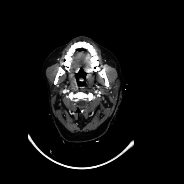Key image 1