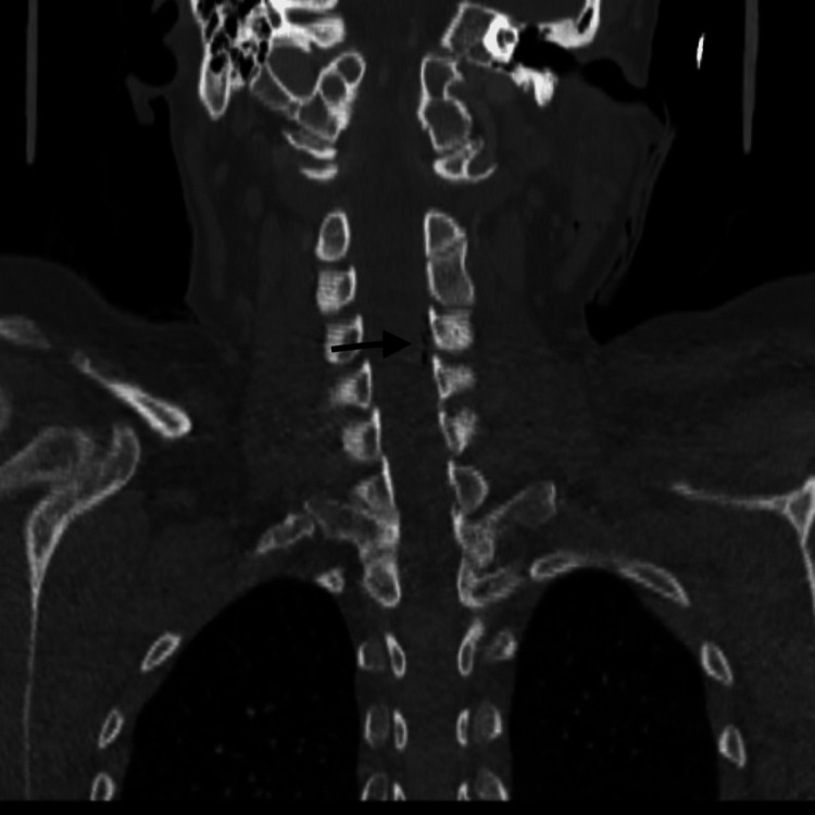 Key image 2