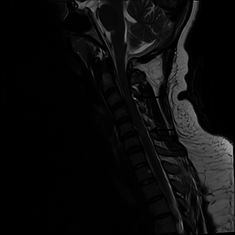 Key image 3