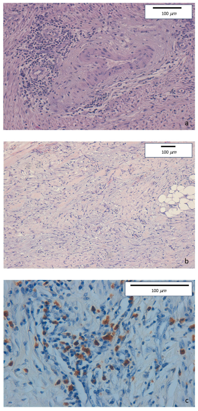 Key image 1