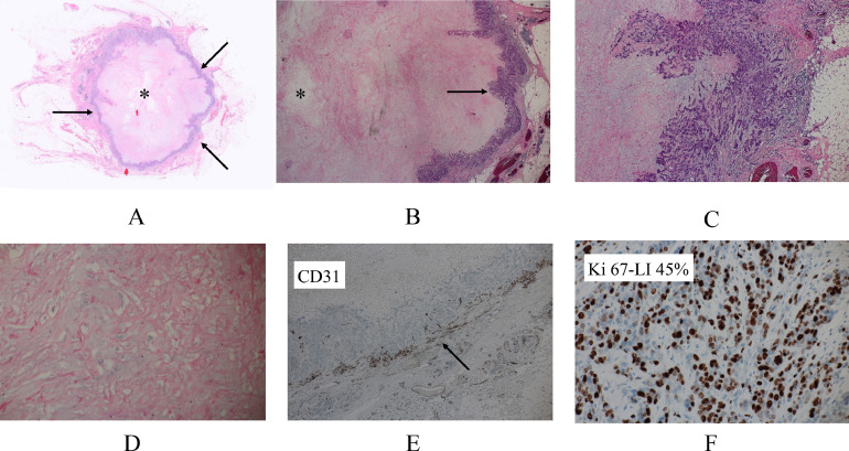 Key image 3
