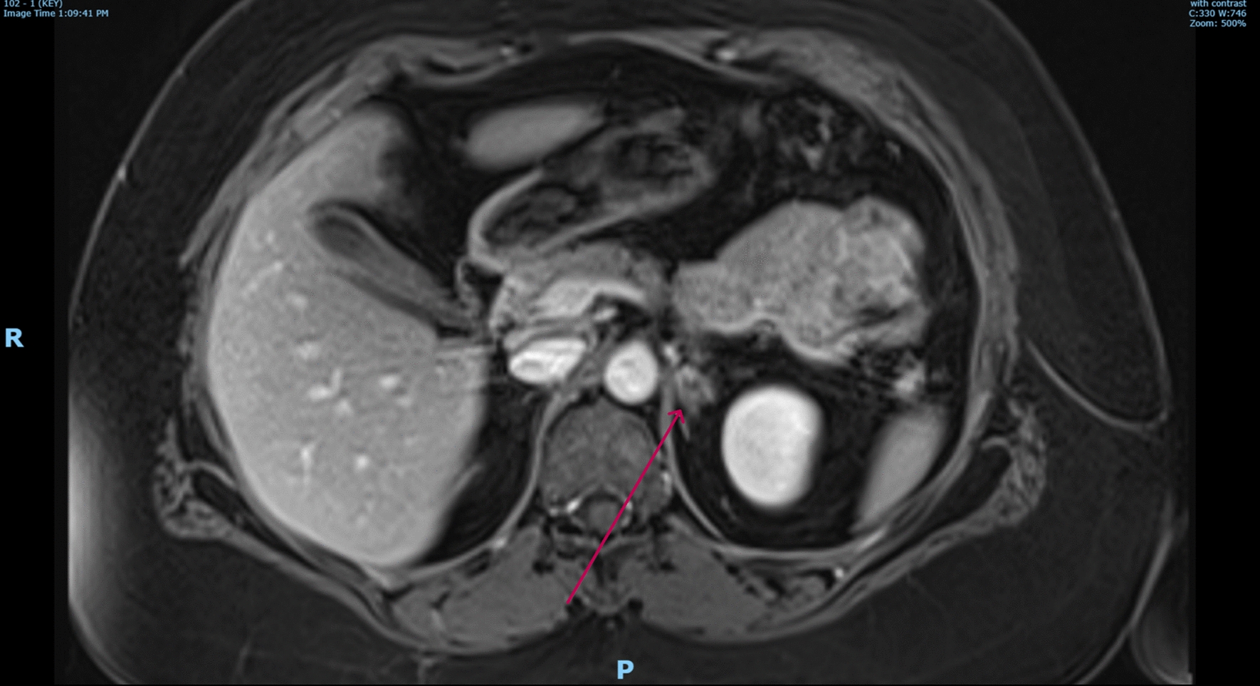 Key image 3