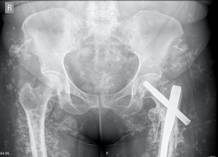 Key image 1