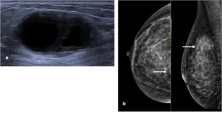 Key image 1