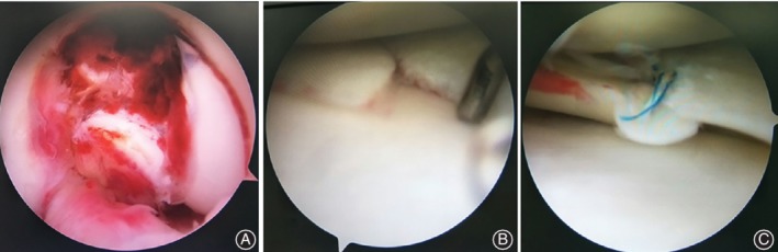Key image 2