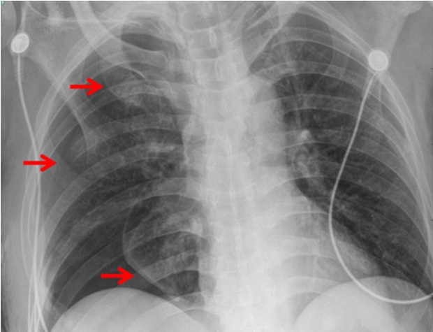 Key image 3
