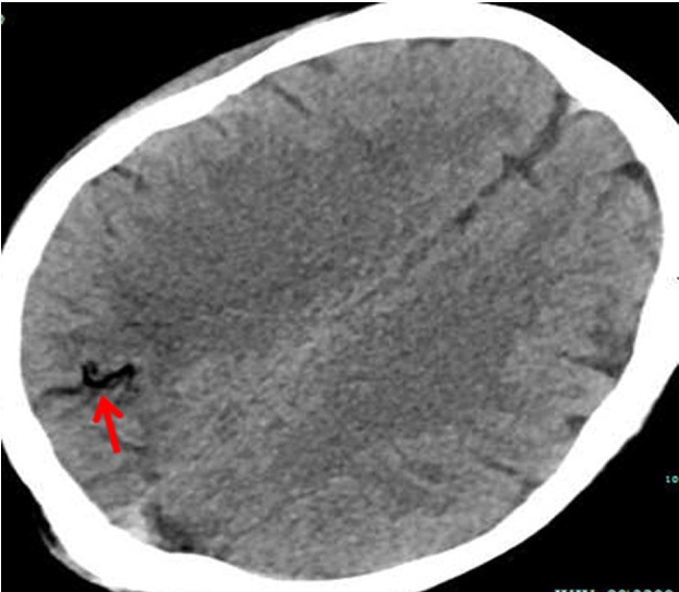 Key image 4