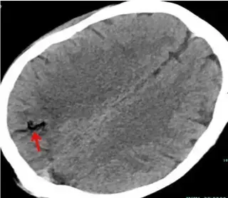 Key image 4